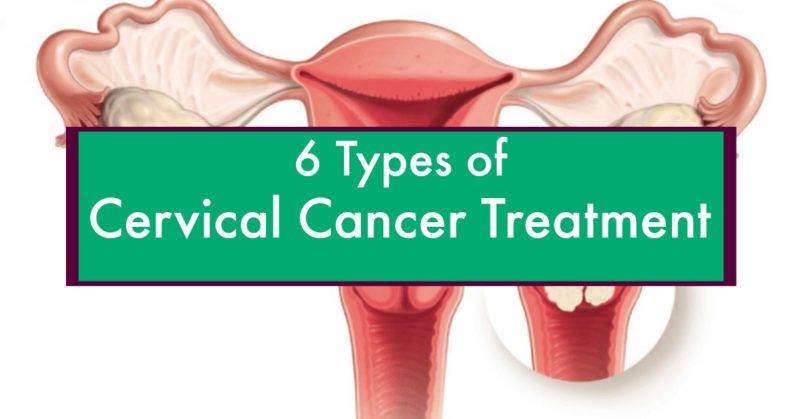 thesis on cervical cancer treatment
