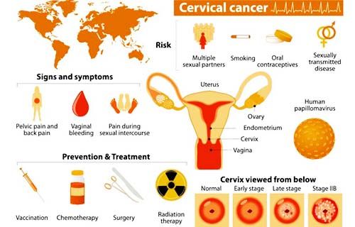 Best Hospital For Cervical Cancer Treatment In Delhi